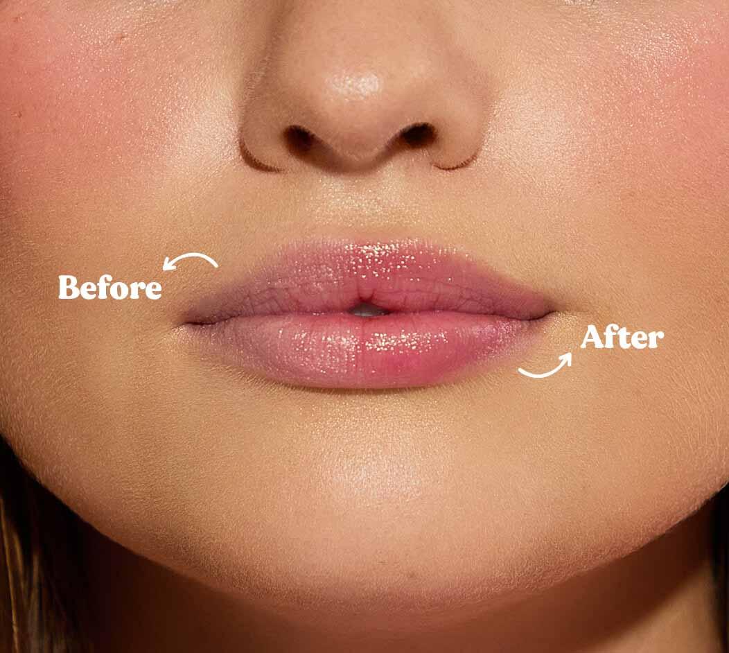 DERMAL THERAPY L/B Tint Rose Pink 8g